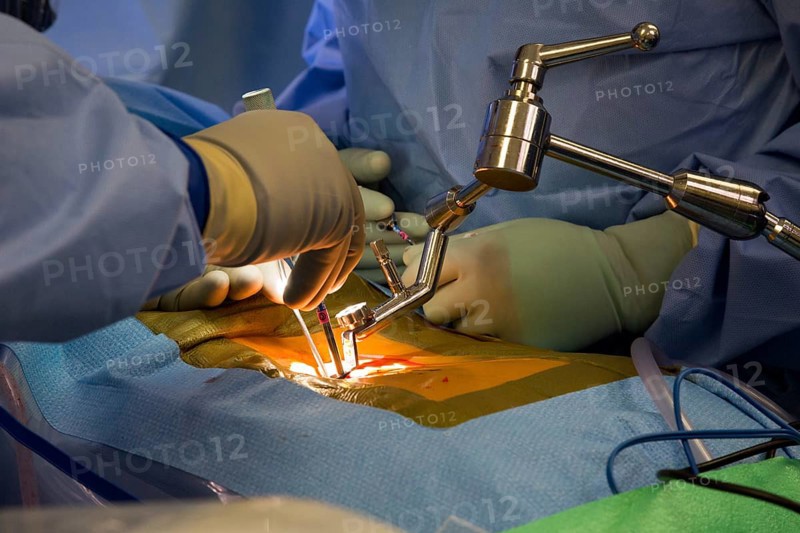 Minimally invasive lumbar spine surgery at Swedish Medical Center