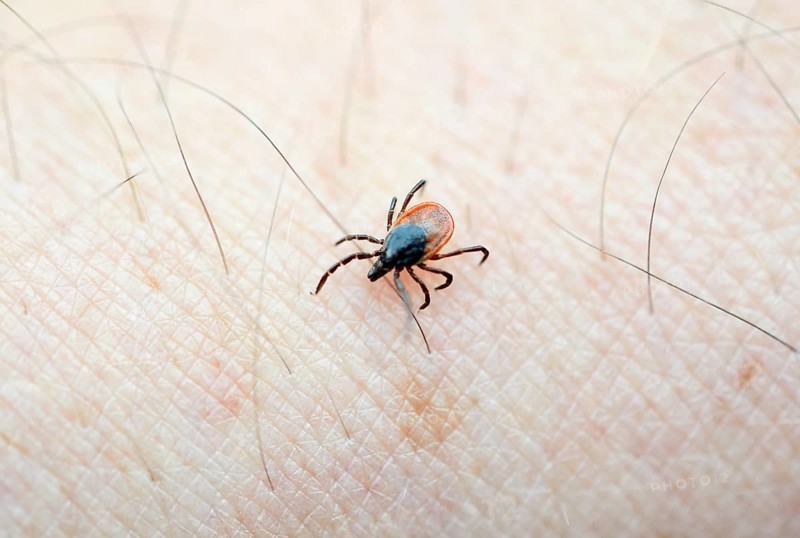 Castor Bean Tick (Ixodes ricinus) crawling on human skin
