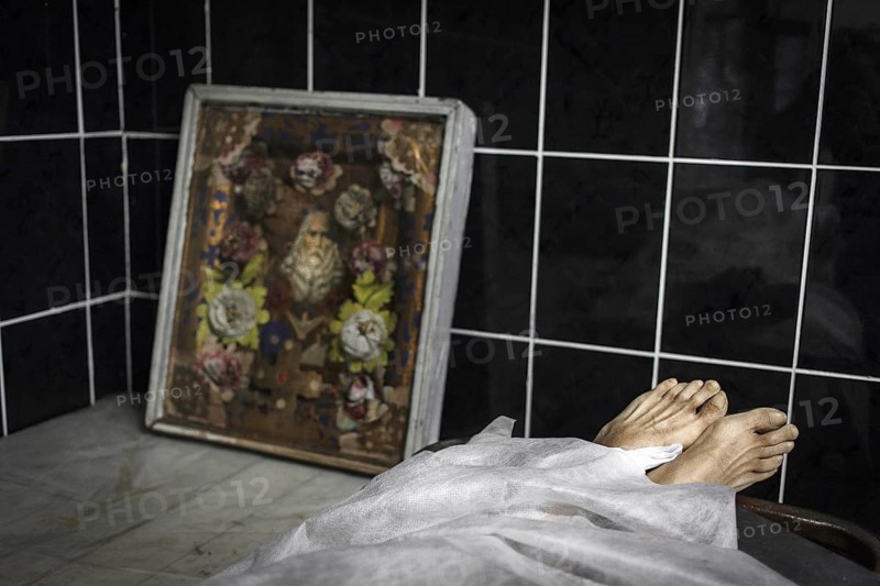 Tuberculosis and HIV in Moldova