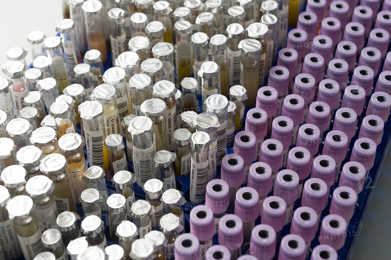 Test tubes with samples in a medical laboratory