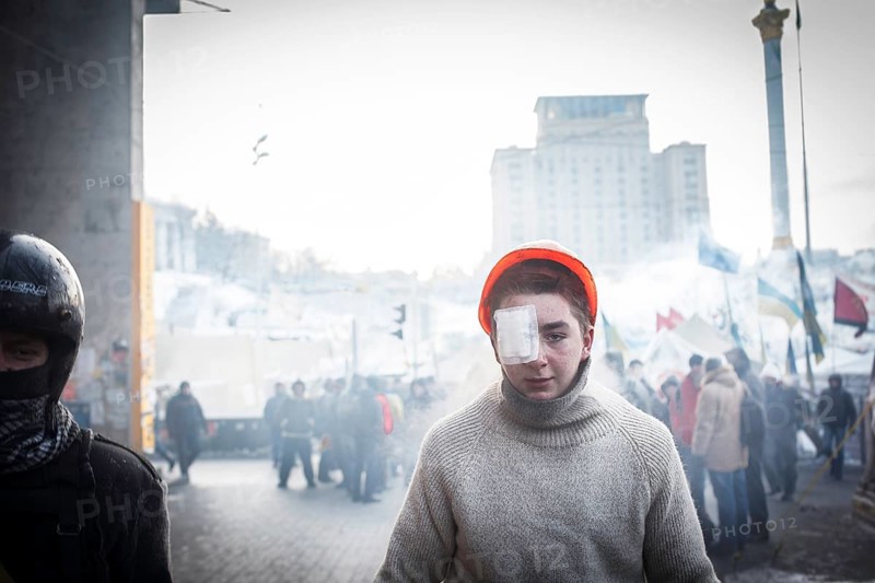 Injured protester