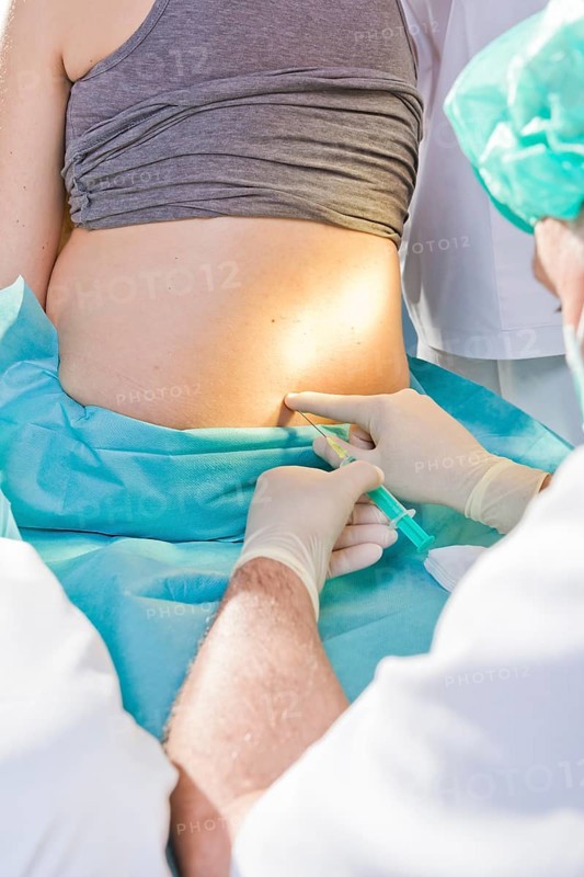 Pregnant women during delivery in the delivery room with an anesthesiologist applying a PDA or epidural