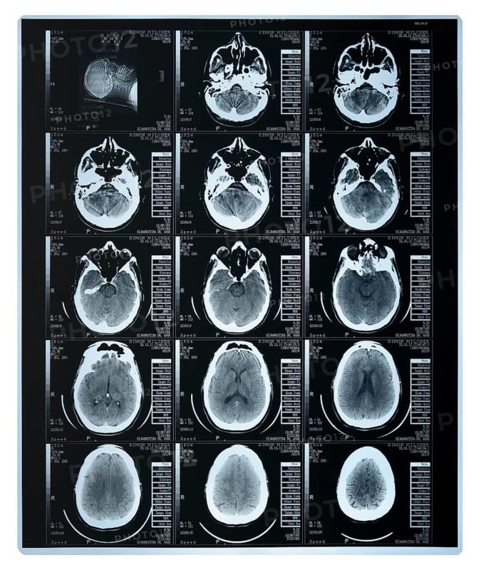 Scan of a human brain