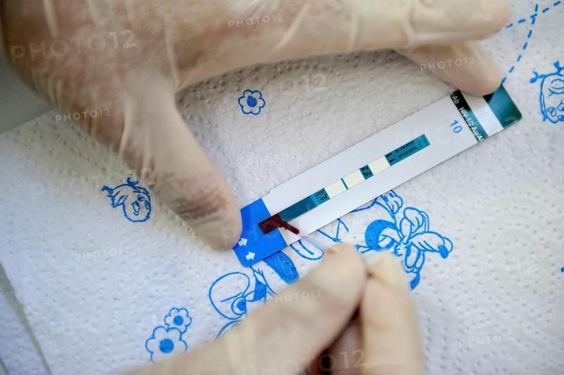 AIDS rapid test with a drop of blood that is taken from the fingertip