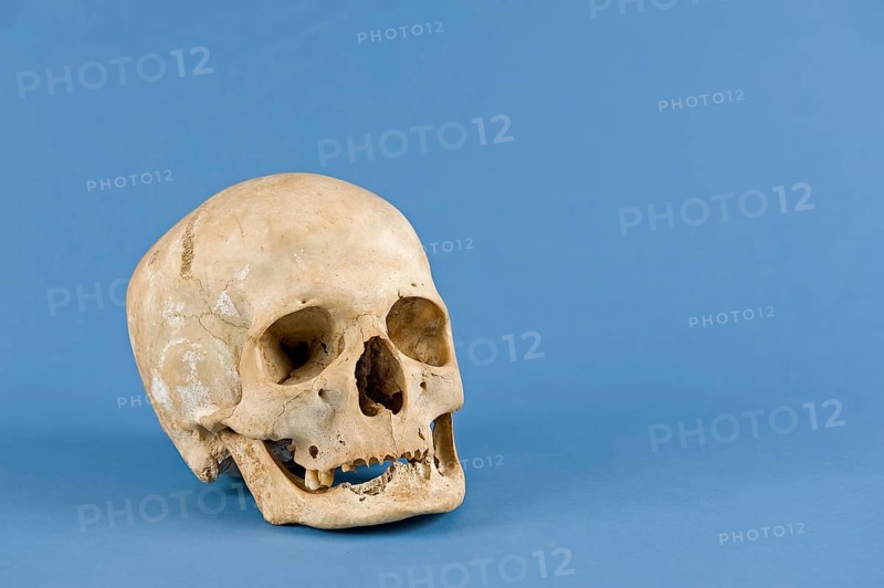 Human skull