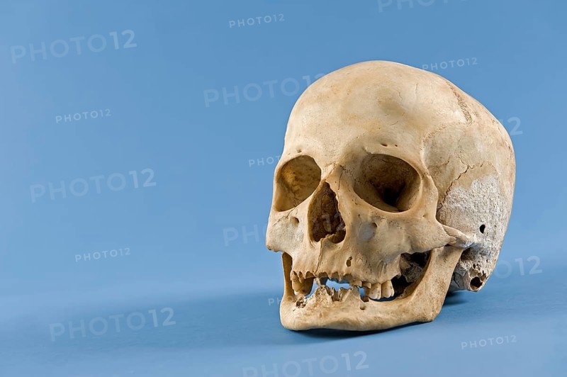 Human skull