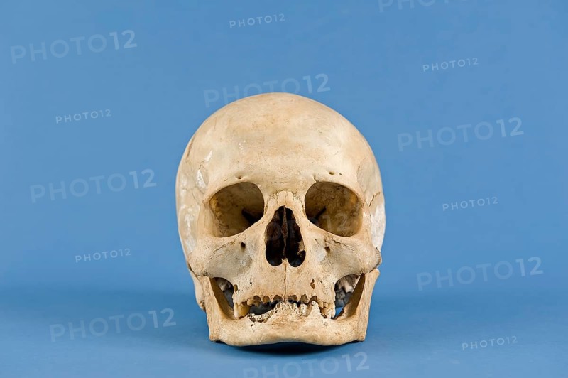 Human skull