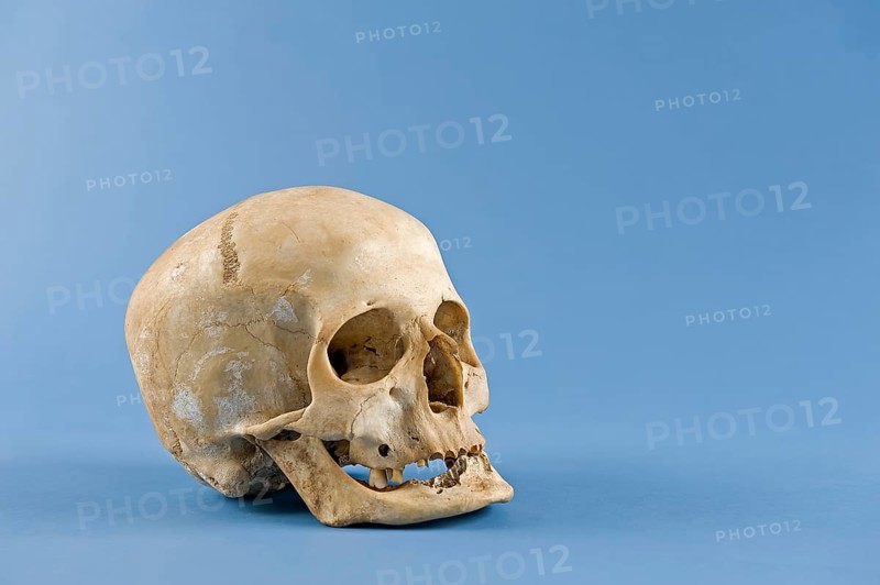 Human skull