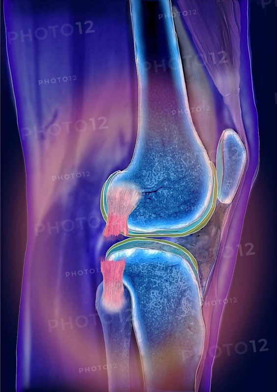 Knee joint