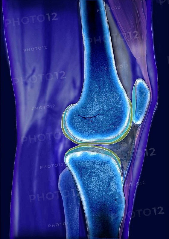 Knee joint