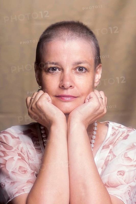 A woman after chemotherapy