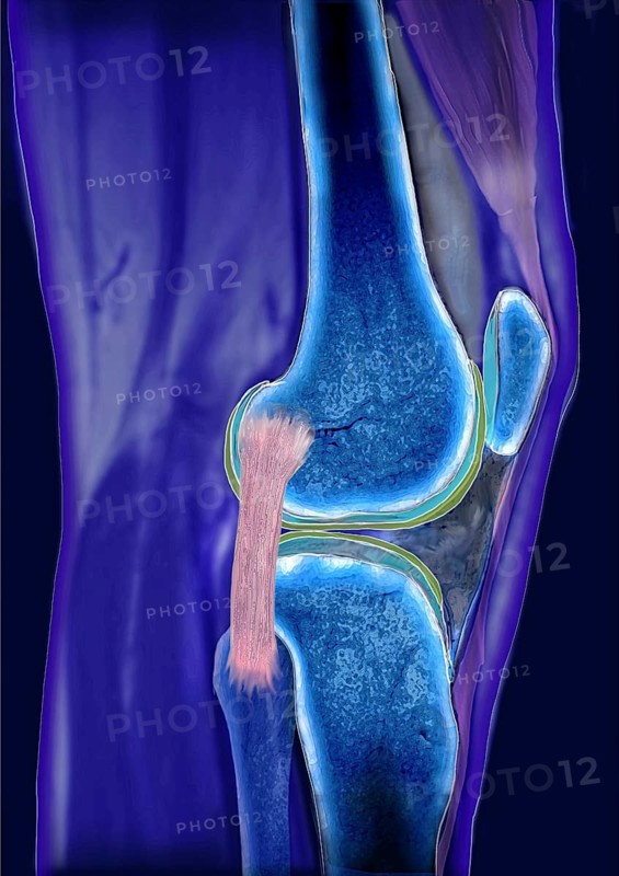 Knee joint