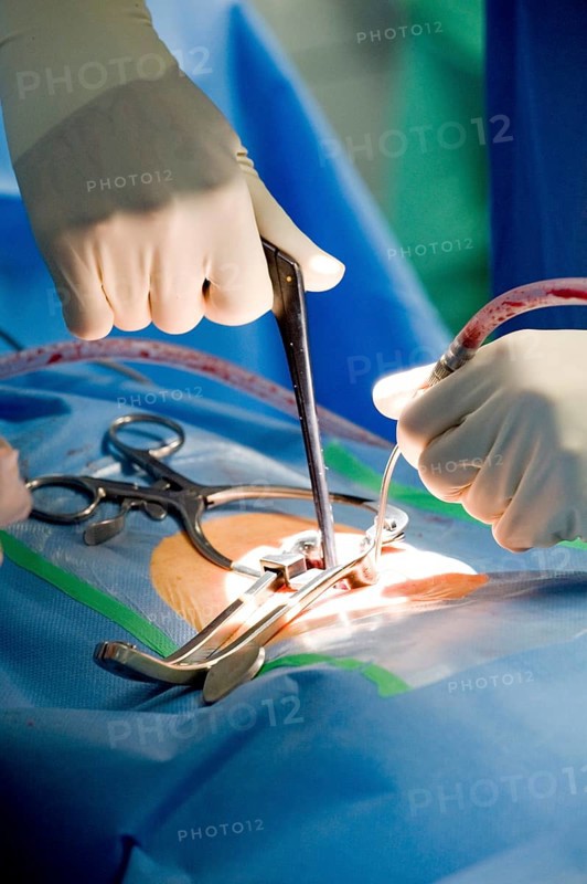 Hands of a neurosurgeon during spinal surgery in an operating room