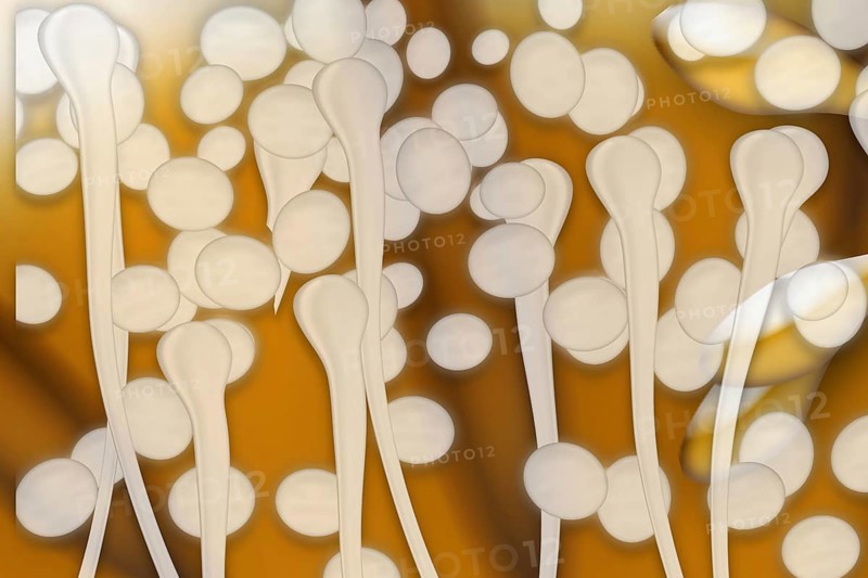 Yeast cells
