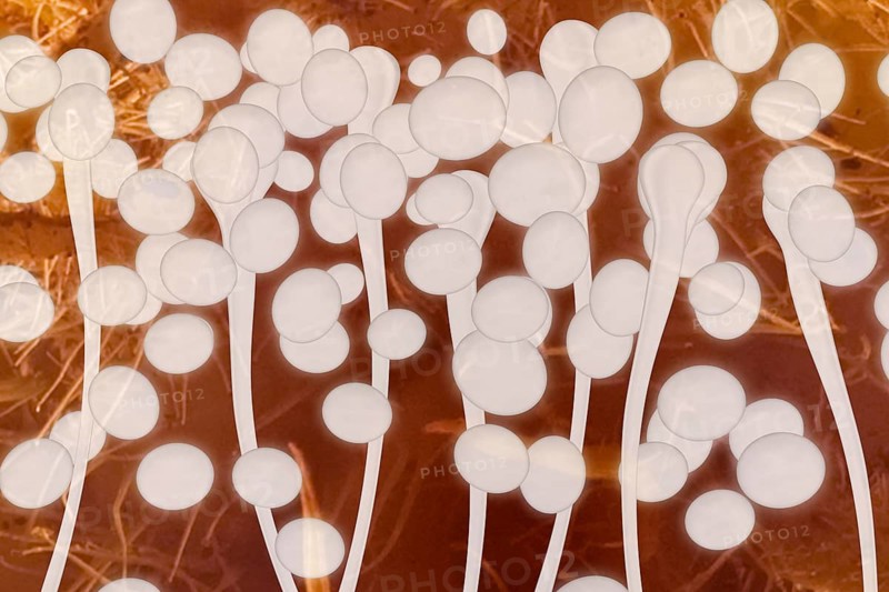 Yeast cells