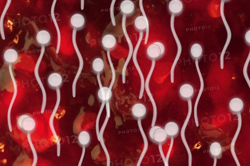 Yeast cells