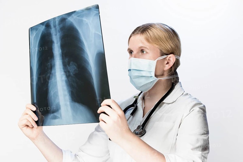 Doctor looks at X-ray image