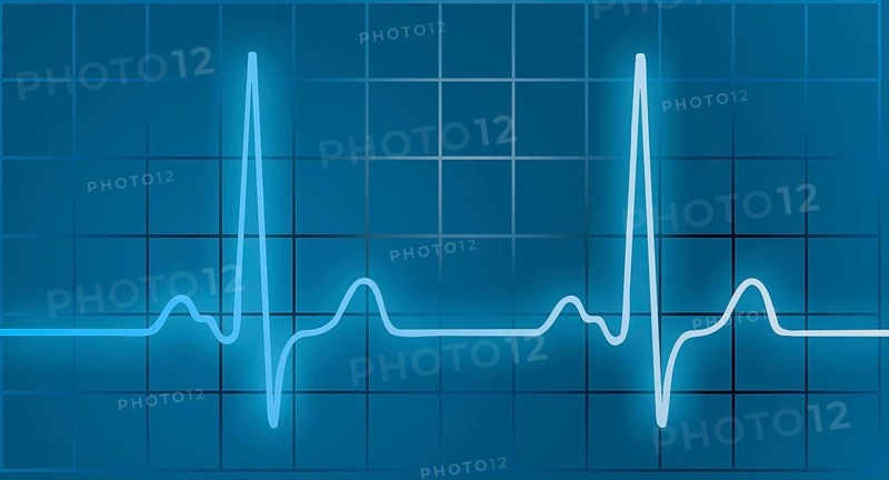 ECG