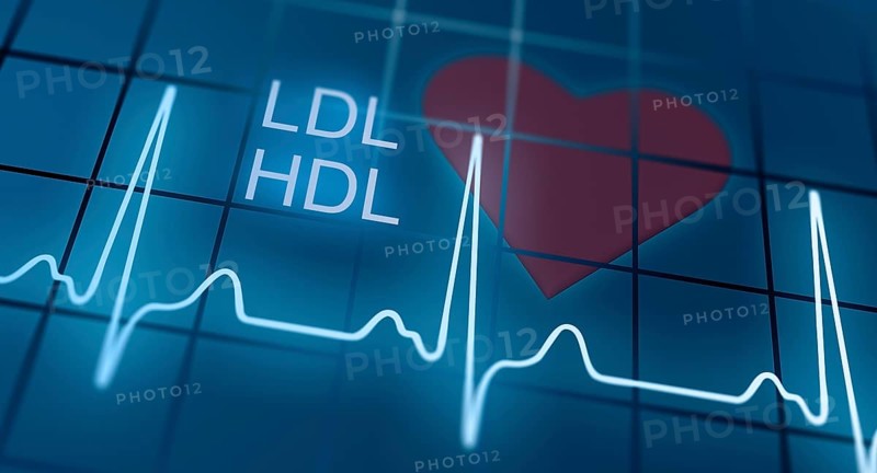 ECG in front of heart symbol