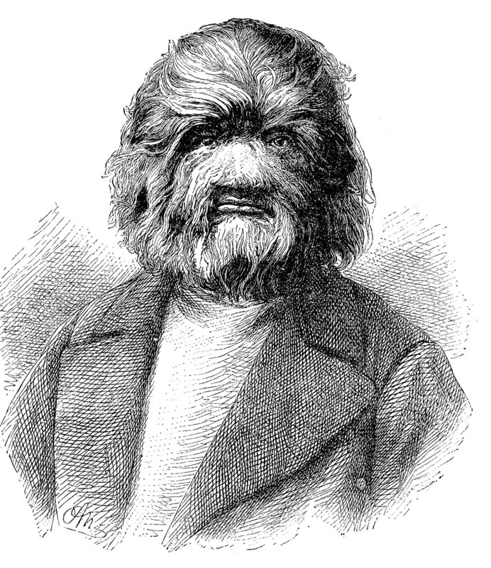 Dog-Faced Man