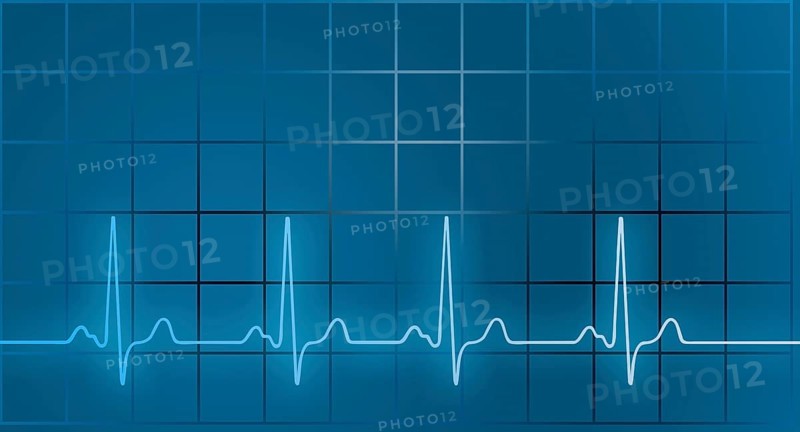ECG