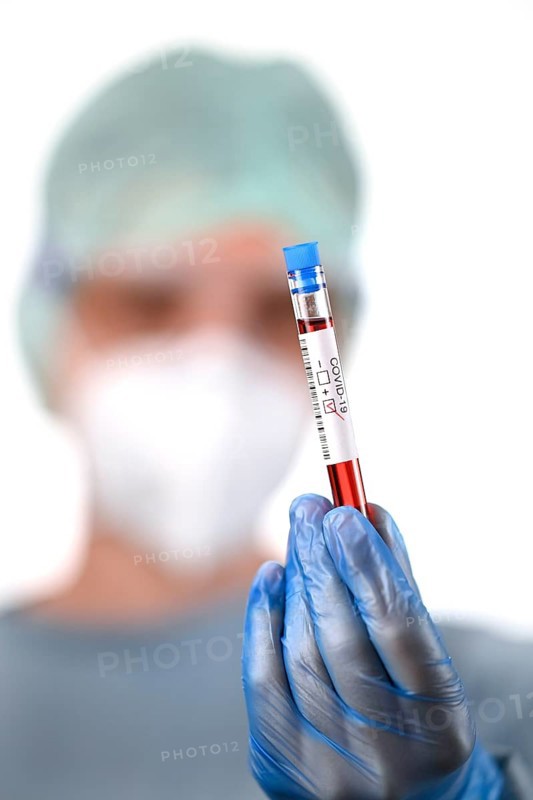 Positive test result