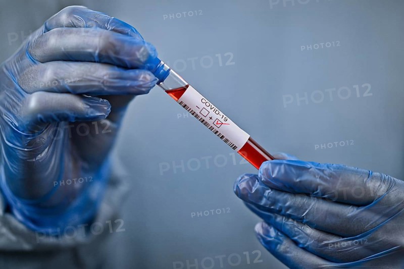 Holding hands with protective gloves Positive test result
