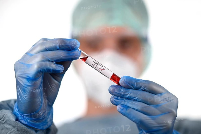 Positive test result