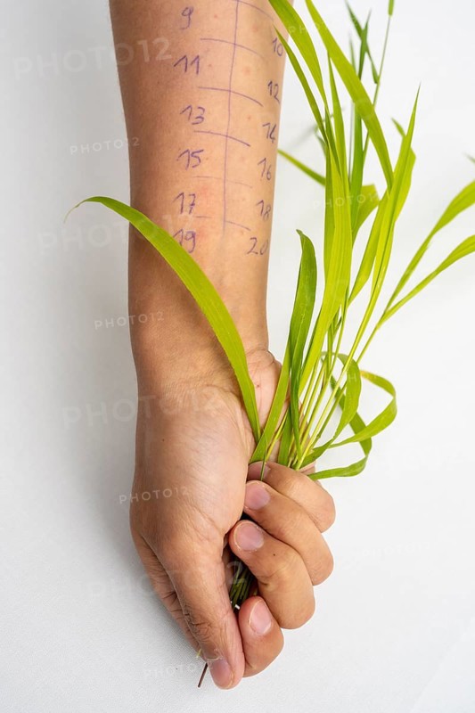 Allergy test