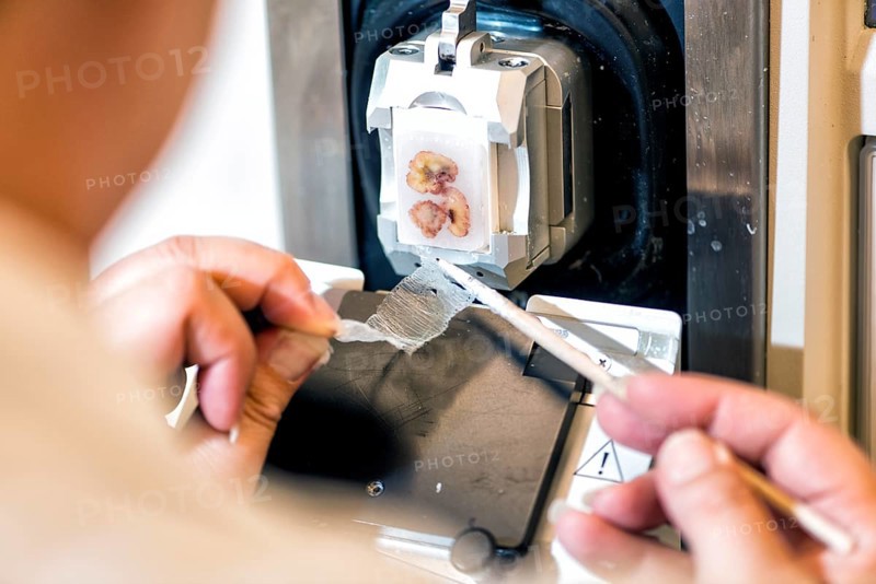 Tissue sample in the laboratory
