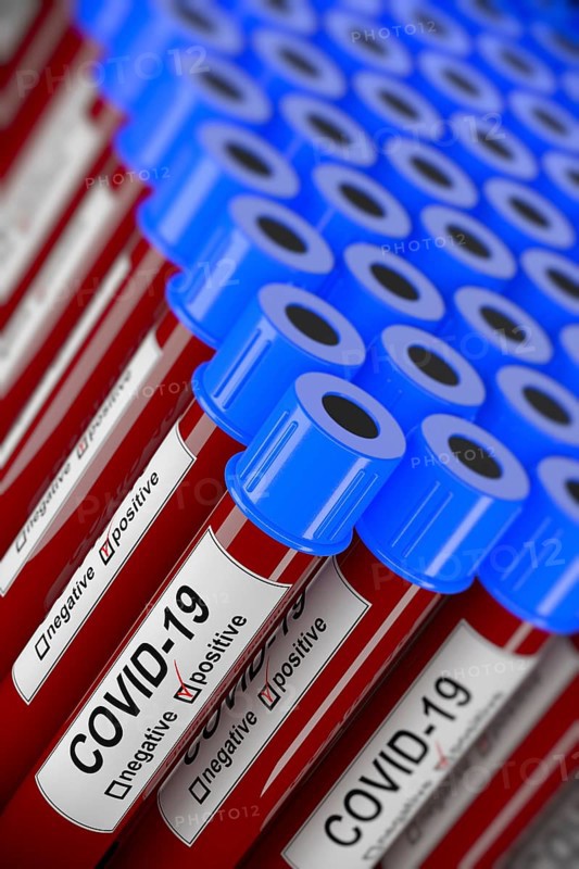 3D illustration of many blood test tubes with positive COVID-19 tests. Concept for laboratory sample of blood testing for diagnosis of the new Corona virus infection with selective focus
