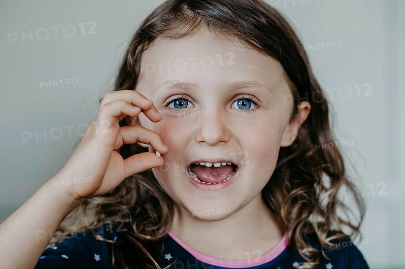 Girl with gap and fallen tooth in her hand