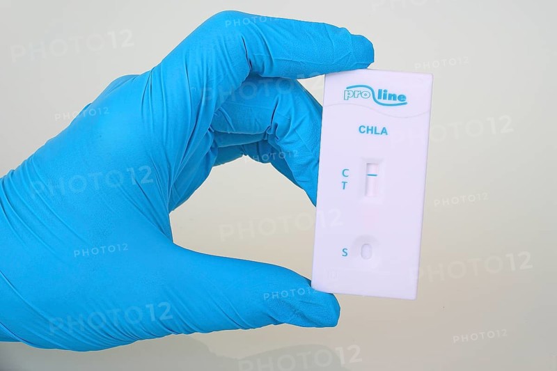 Quick test Chlamydia from ProLine