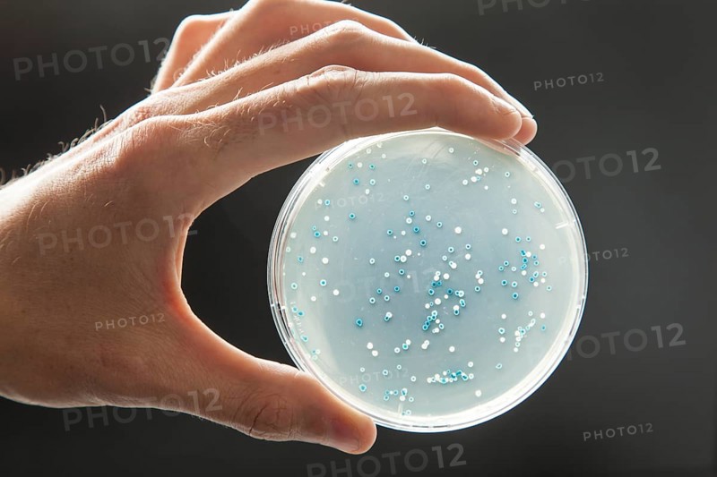Petri dish with a transformation of