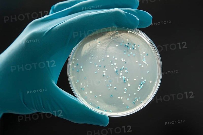 Petri dish with a transformation of
