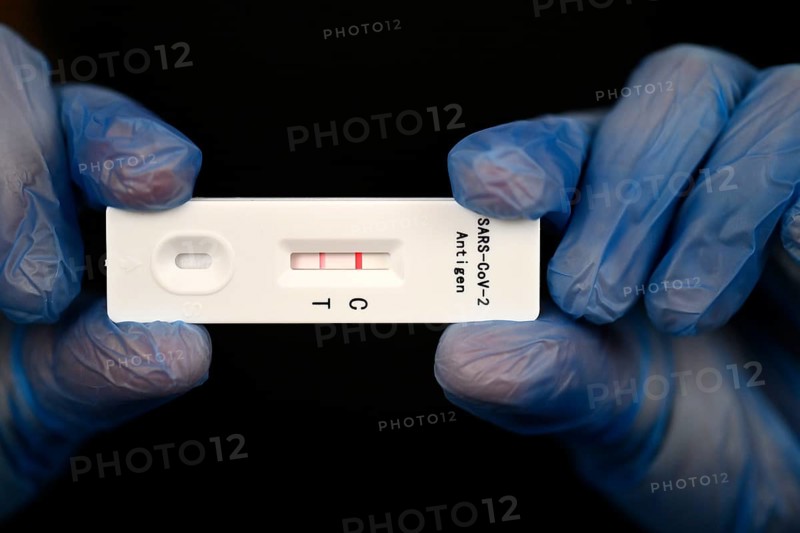 Positive antigen rapid test