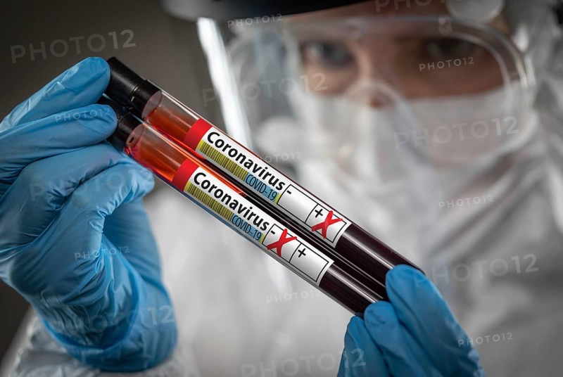 Female Lab Worker Holds Test Tubes of Blood Labeled Coronavirus COVID-19 Disease