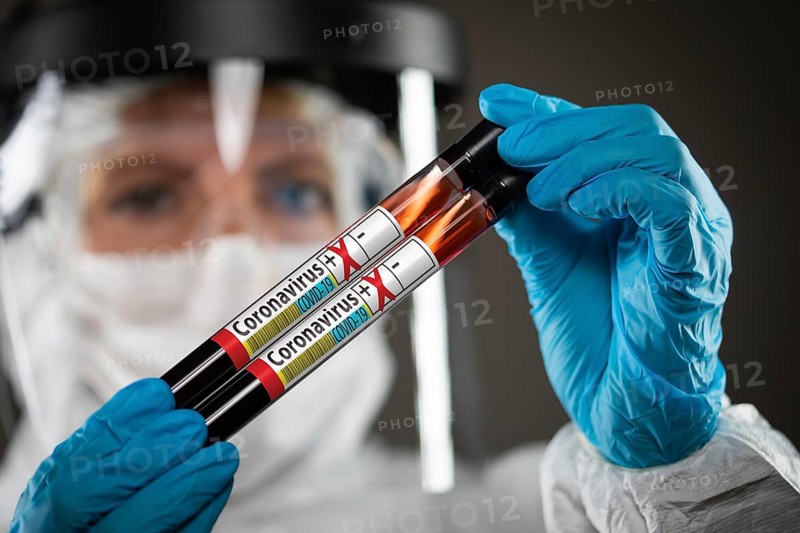 Female Doctor or Nurse Holding Test Tubes of Blood Labeled Positive for Coronavirus COVID-19 Disease