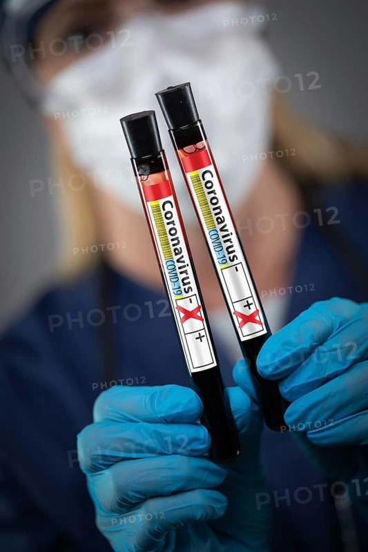 Female Lab Worker Holds Test Tubes of Blood Labeled Coronavirus COVID-19 Disease