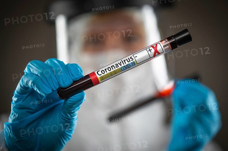 Female Doctor or Nurse Holding Test Tube of Blood Labeled Positive for Coronavirus COVID-19 Disease