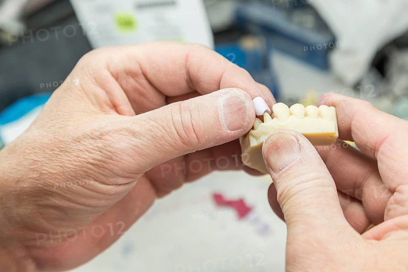 Male dental technician working on A 3D printed mold for tooth implants in the lab