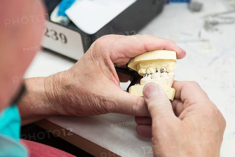 Male dental technician working on A 3D printed mold for tooth implants in the lab