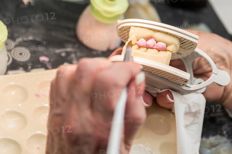 Female dental technician applying porcelain to A 3D printed implant mold in the lab