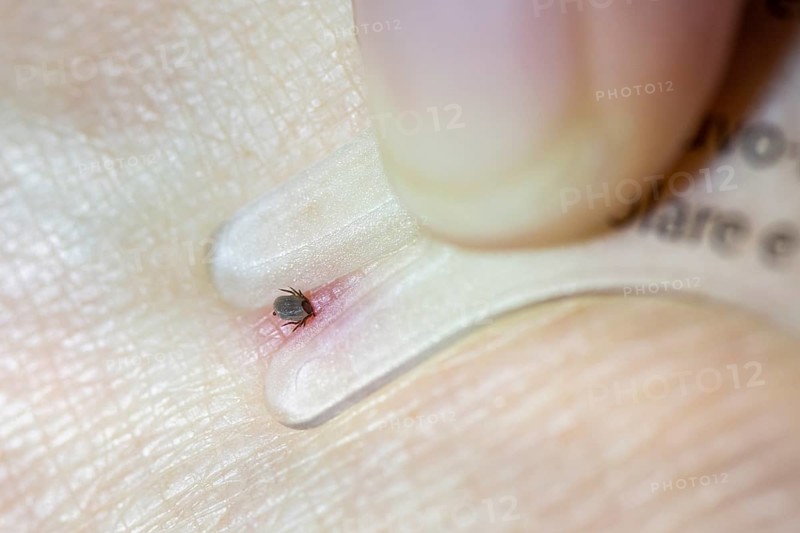 Castor Bean Tick (Ixodes ricinus)