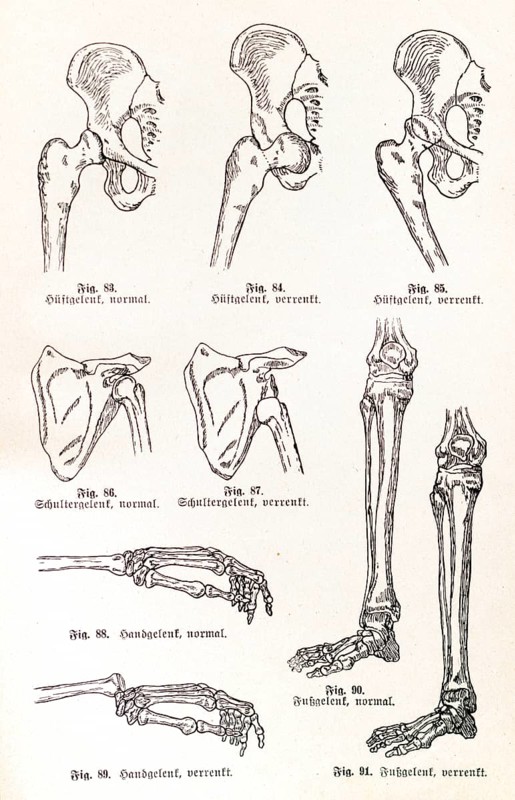 Dislocations (Lurations)