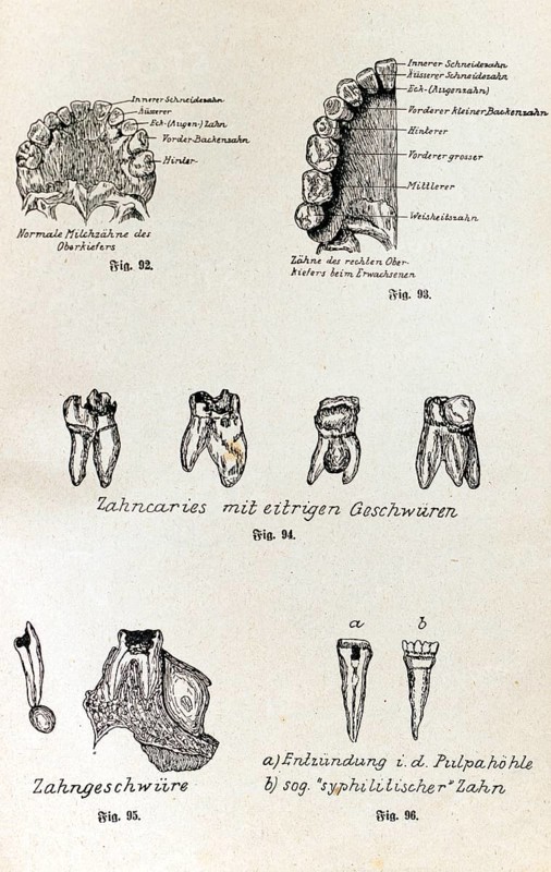 The teeth and their diseases