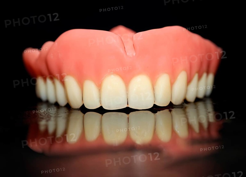 Full denture for the upper jaw made of plastic