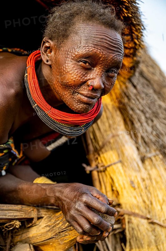 Scar face as a mark of beauty woman