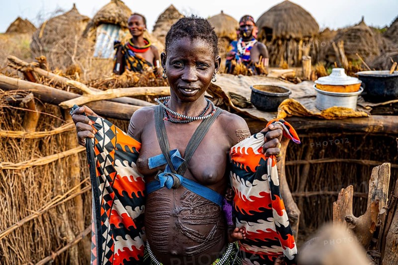 Woman with many beauty scars on her body