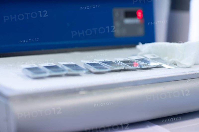 Embedded samples in a histology laboratory